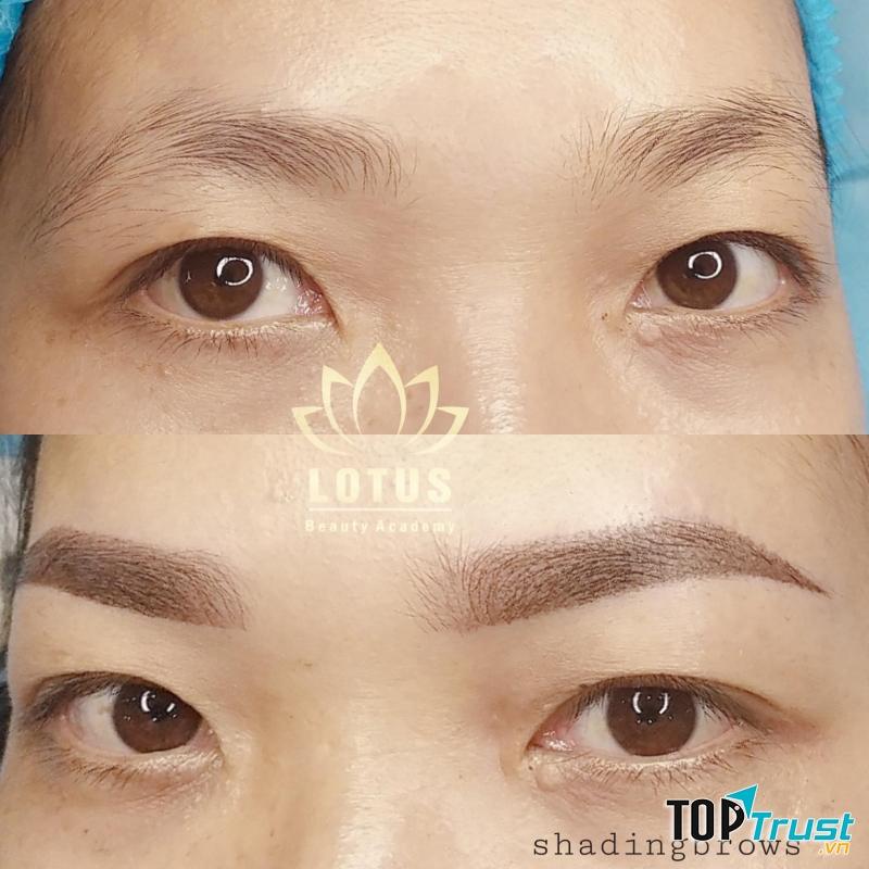 Lotus Beauty and Spa Rạch Giá