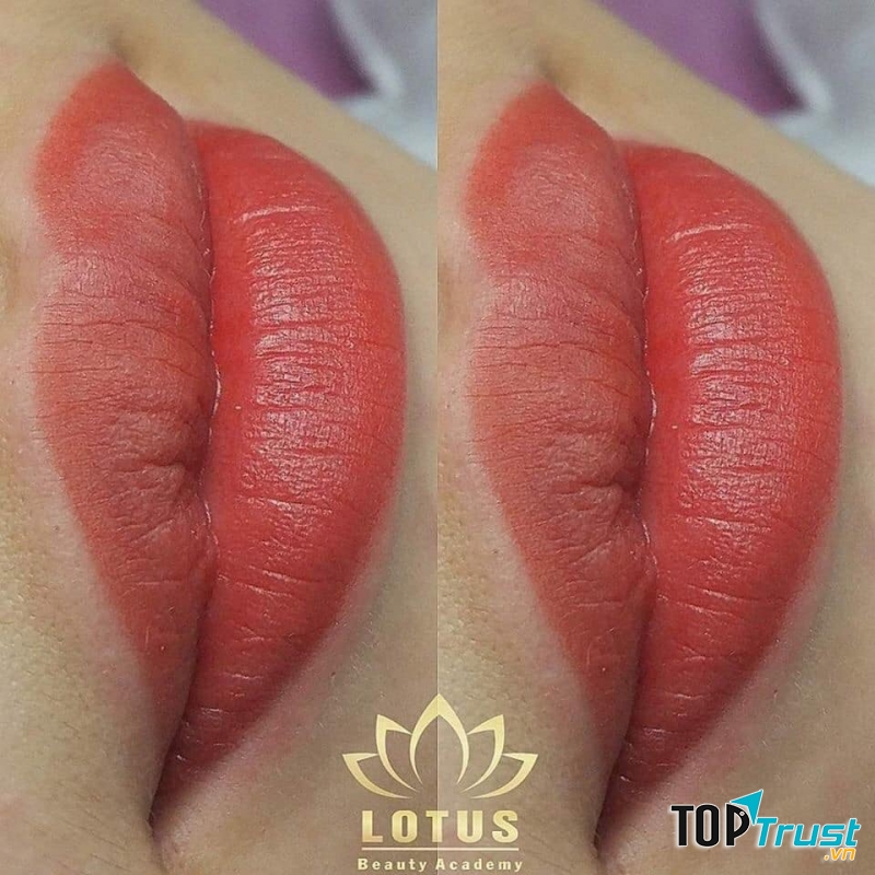 Lotus Beauty and Spa Rạch Giá