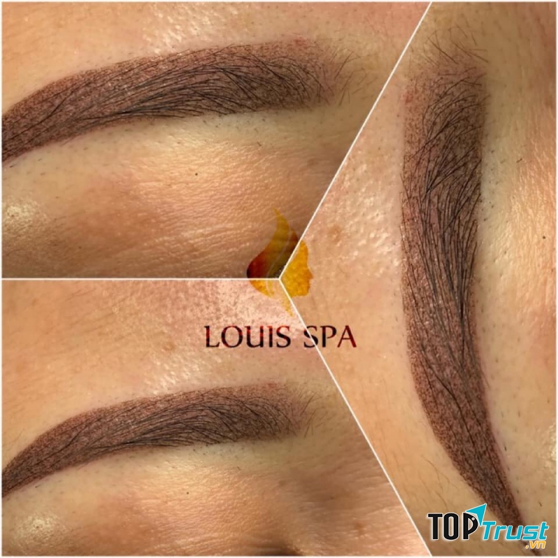 LOUIS SPA ĐÔNG HÀ