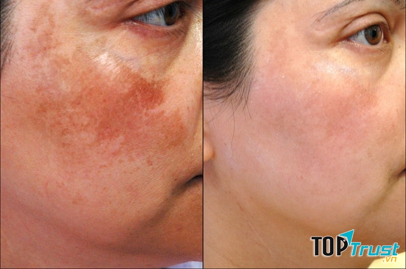 LOUIS SPA QUẢNG NGÃI - Viện Thẩm Mỹ Công Nghệ Cao