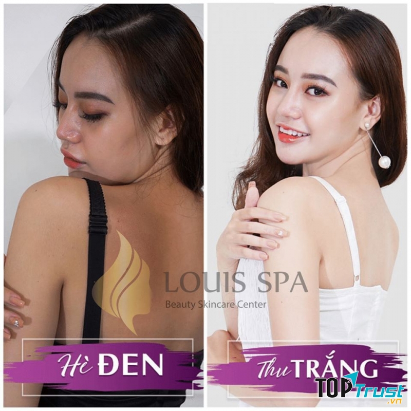 Louis Spa Viện Thẩm Mỹ Công Nghệ Cao