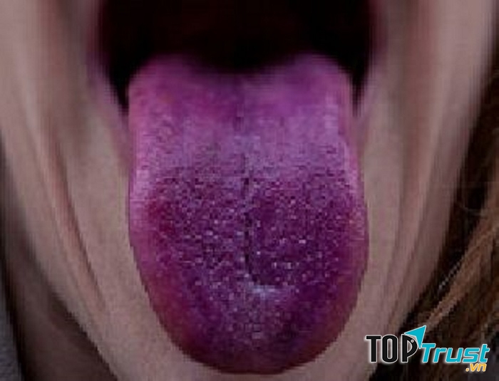 Đây là dấu hiệu chứng tỏ bạn đang có vấn đề về lưu thông máu