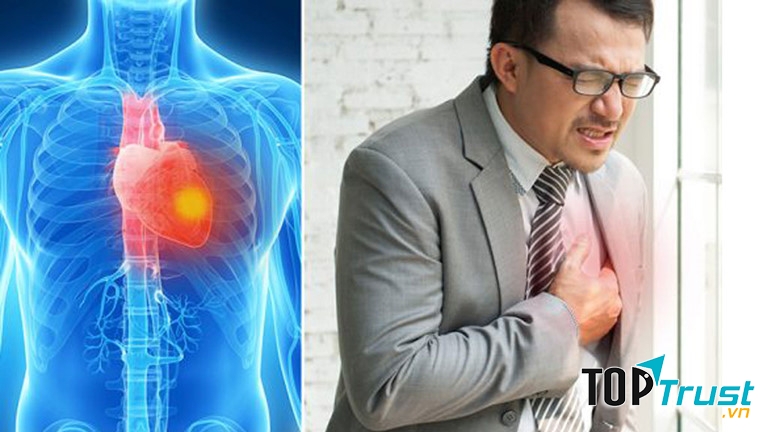 Ảnh minh họa - nguồn internet