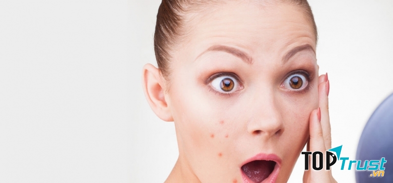 Da có mụn là da không được làm sạch đúng cách