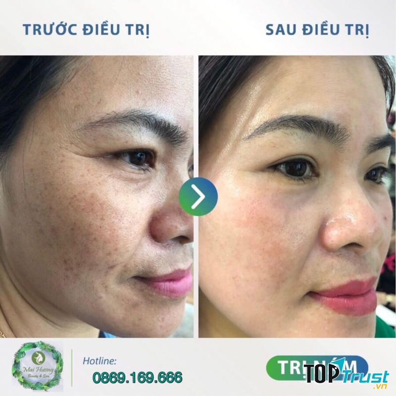 Mai Hương Beauty & Spa