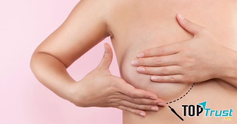 Massage trị liệu giúp mẹ vừa thoải mái vừa trị chứng tắc tia sữa