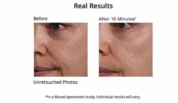 Với Mặt Nạ Chống Lão Hóa Murad Age Diffusing Firming Mask giúp phục hồi lại cấu trúc thon gọn của làn da, lấy lại vẻ đẹp thanh xuân cho da hiệu quả nhất.