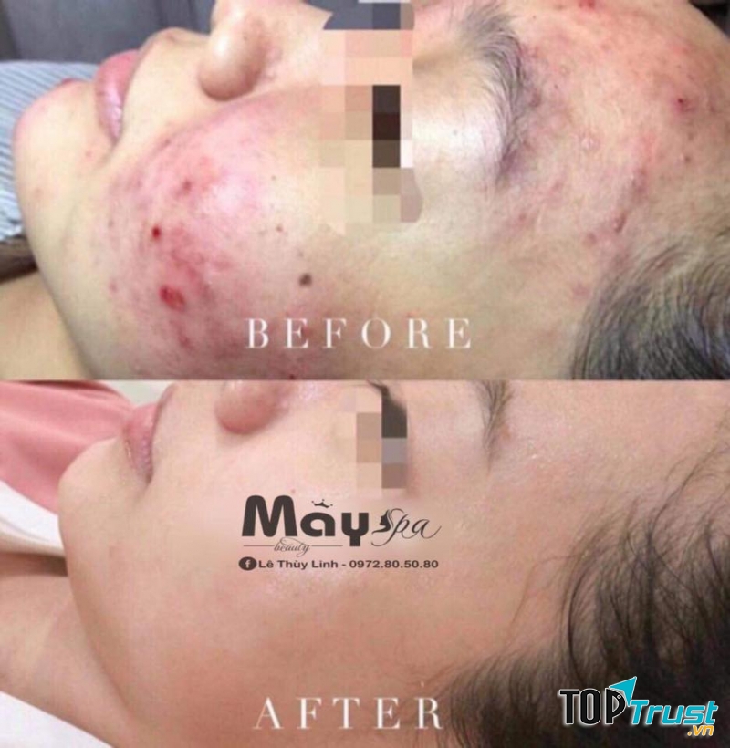 MÂY Spa