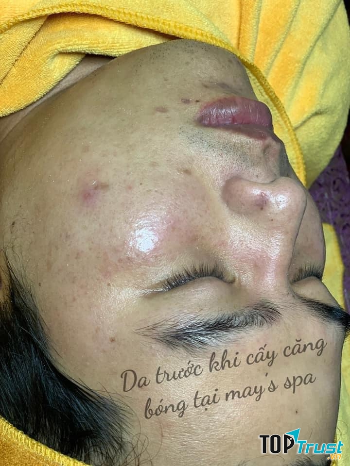 May's Spa Đà Lạt