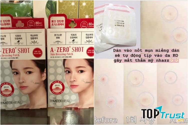 Miếng dán mụn Mediheal