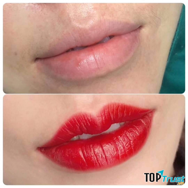 Thu Hương Korea - Thẩm mỹ Hàn Quốc