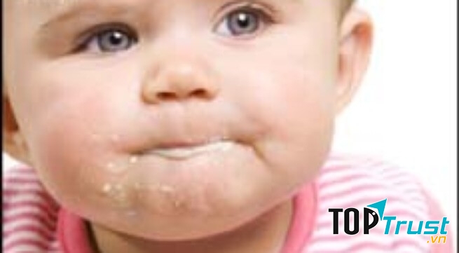 Mẹo chữa trớ cho bé