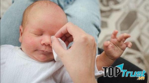 Mẹo vệ sinh khi mắt bé bị đổ ghèn