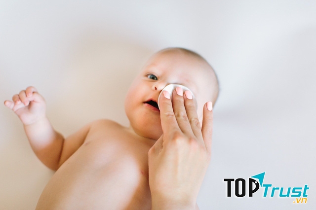 Mẹo vệ sinh khi mắt bé bị đổ ghèn