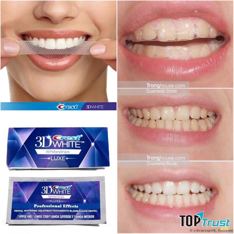 Crest 3D White Whitestrips Advanced Vivid 25X là miếng dán trắng răng thế hệ mới, cung cấp năng lượng giúp làm trắng răng gấp 5 lần so với các sản phẩm thông thường.