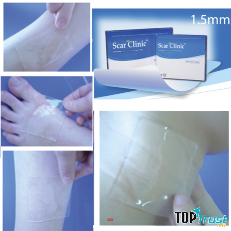 Miếng dán trị sẹo Scar Clinic