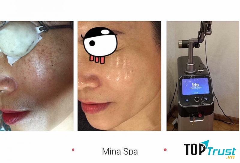Mina Spa