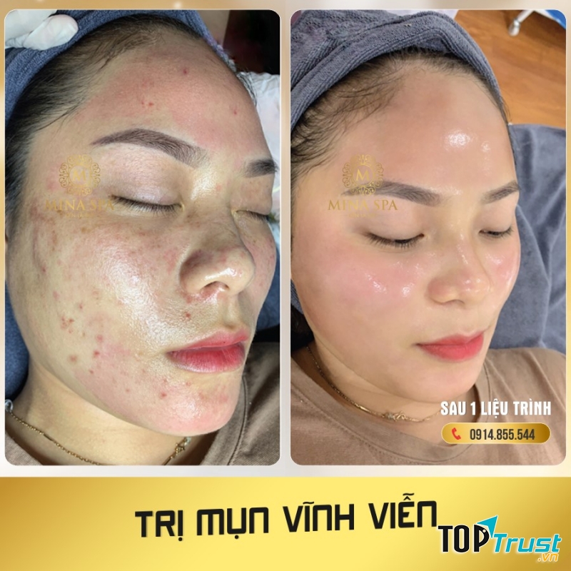 MINA SPA QUẢNG NGÃI