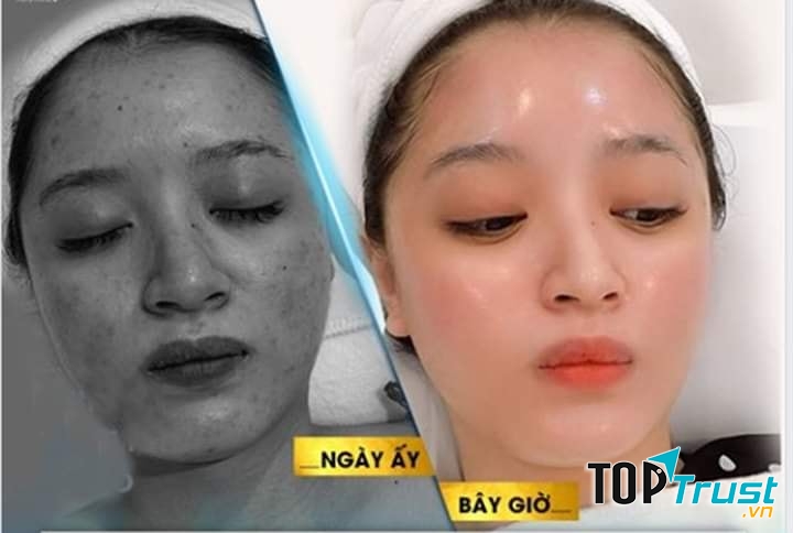 Minh Tuệ Beauty Spa