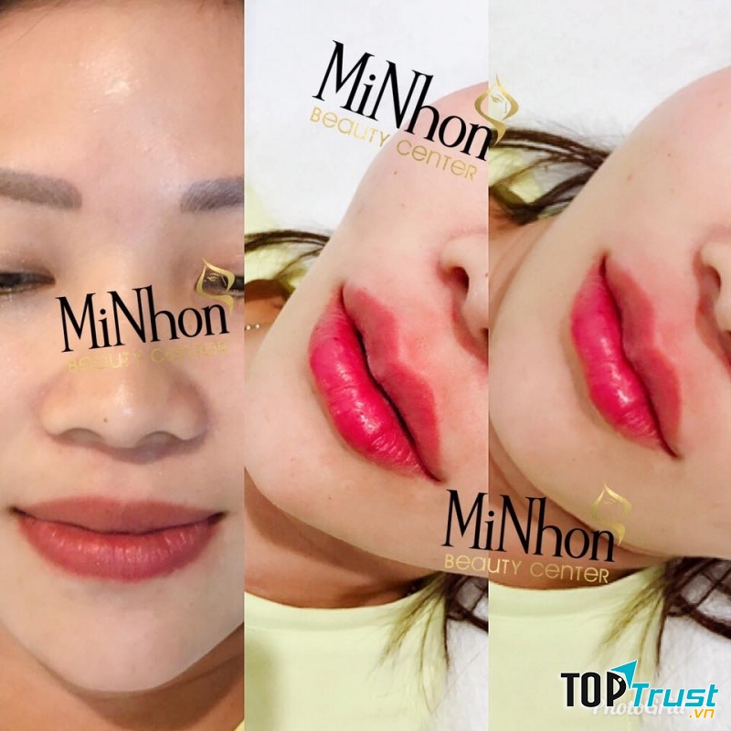 Minhon Beauty Center