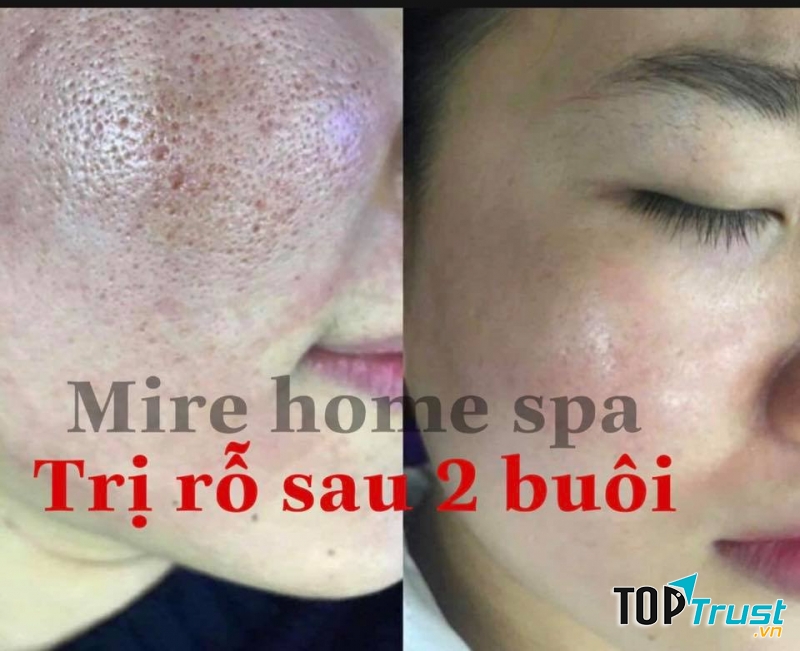 MiRe Home Spa