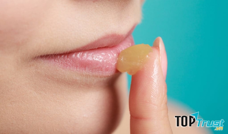 Mỡ gia cầm, mỡ trăn trị nẻ hiệu quả