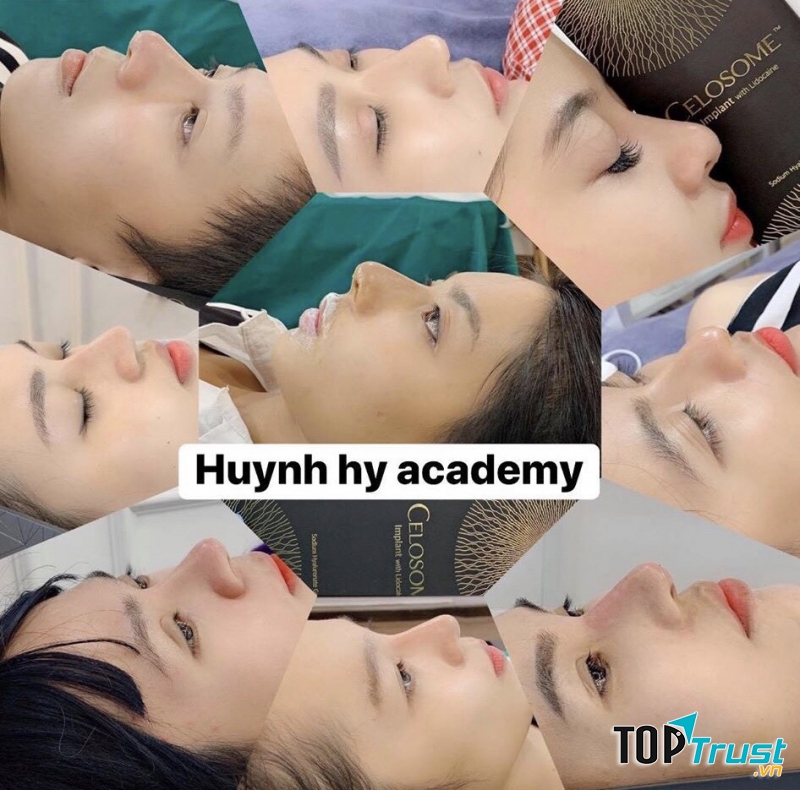 Mộc Beauty Spa (Huynh Hy Academy - Tiêm Filler Nhấn Mí Số 1 Phú Quốc)