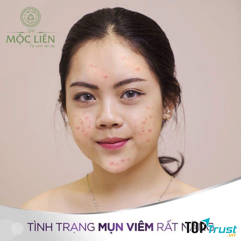 Mộc Liên Spa Cẩm Phả