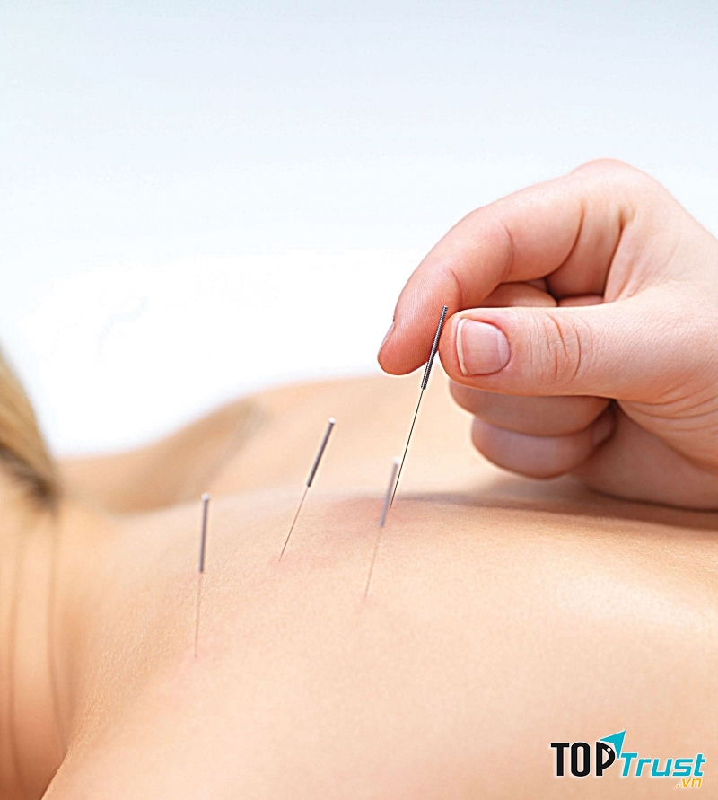 Một số phương pháp điều trị