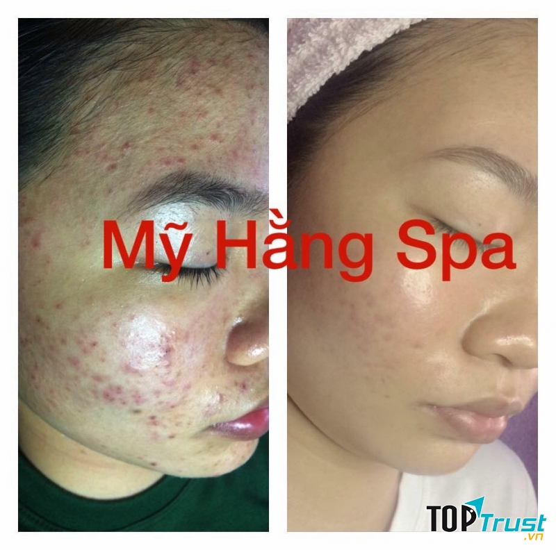 Mỹ Hằng Spa
