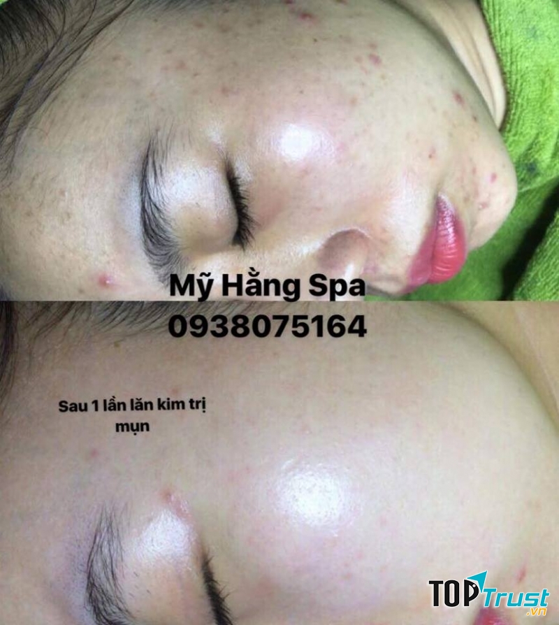 Mỹ Hằng Spa