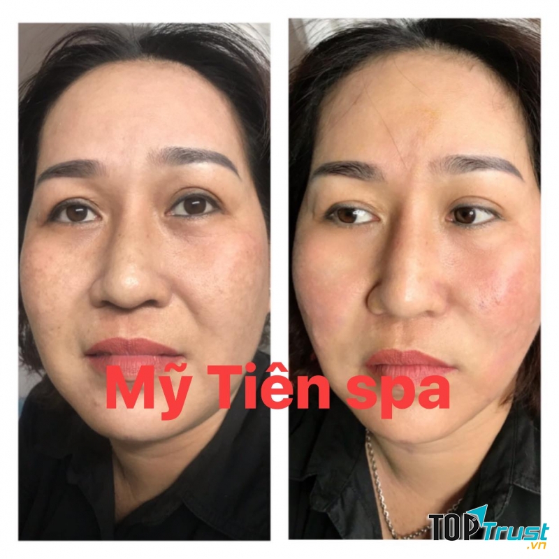 Mỹ Tiên Spa Bến Tre