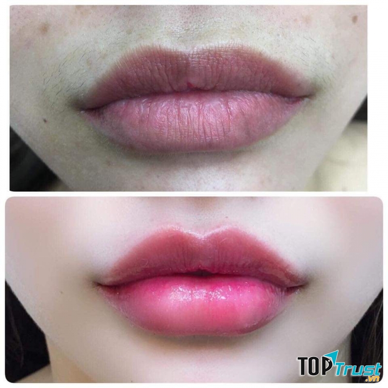 Mỹ Viện Charming