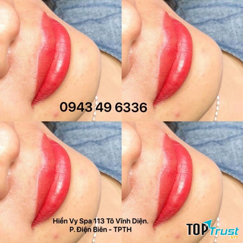 Mỹ Viện Hiền Vy