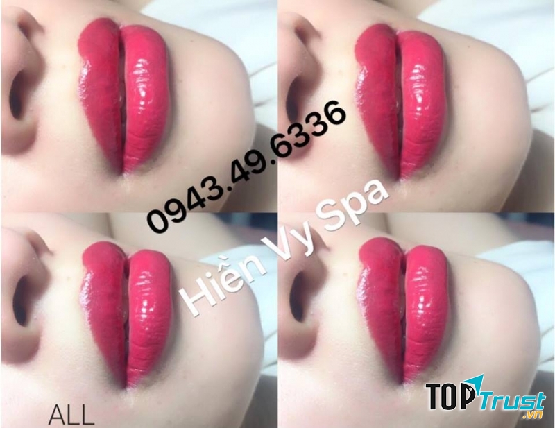 Mỹ Viện Hiền Vy