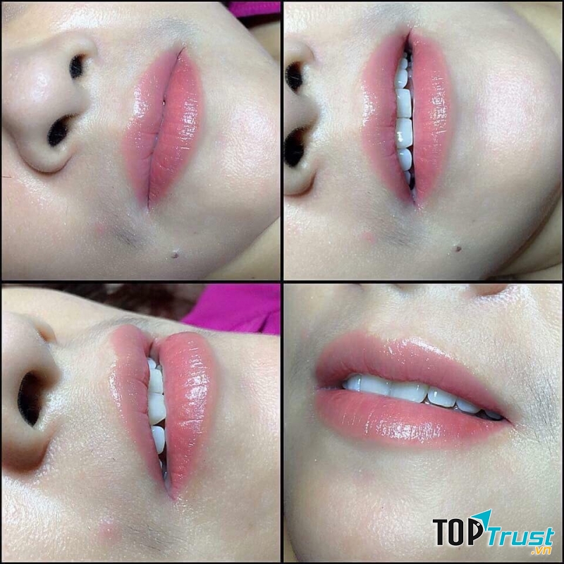 Mỹ Viện Hoàng Kim