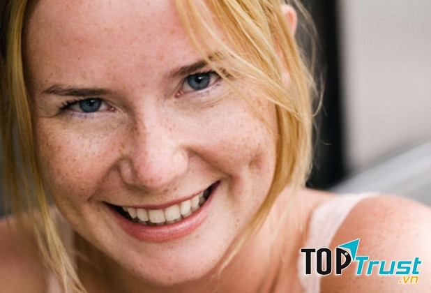 Nám da do di truyền từ mẹ sang con