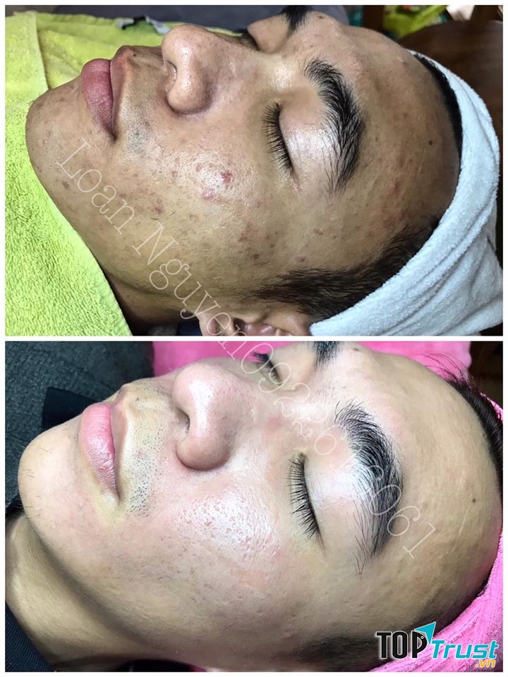 Loan Nguyen Skincare & Spa