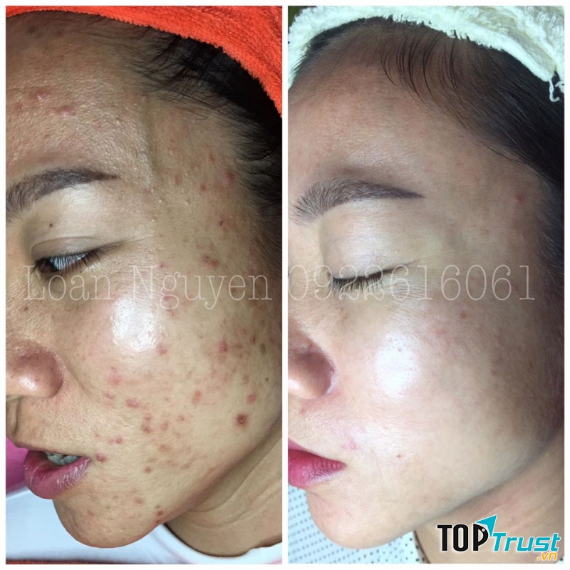 Loan Nguyen Skincare & Spa