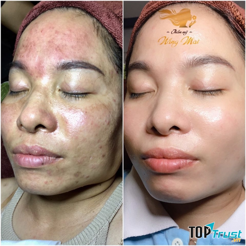 Nắng Mai Spa