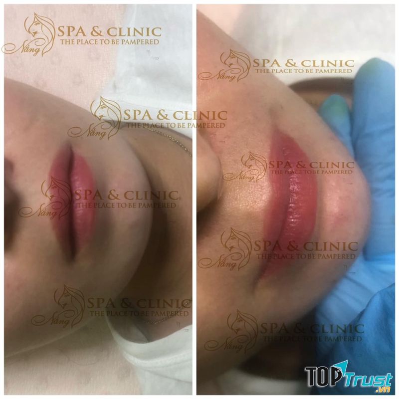 Nắng Spa Beauty & Clinic