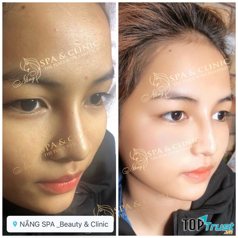 Nắng Spa Beauty & Clinic