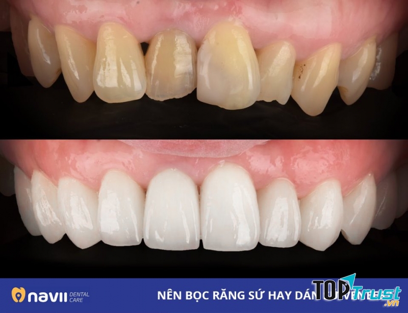 Navii Dental Care