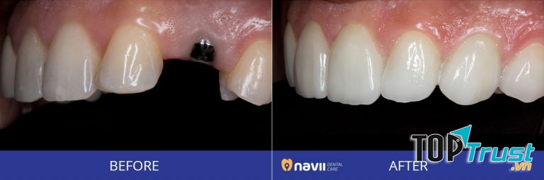 Navii Dental Care