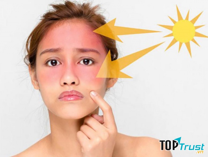 Ngăn ngừa tác động của tia cực tím
