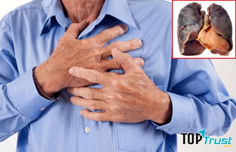 Ảnh minh họa - nguồn internet