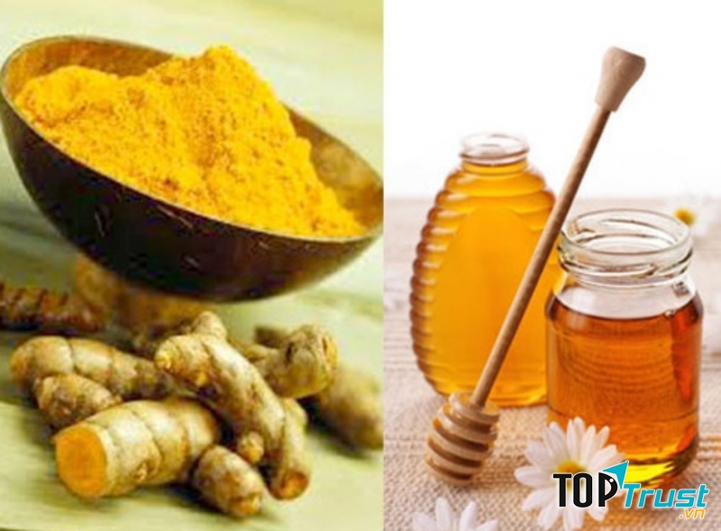 Nghệ và mật ong thần dược chữa đau dạ dày