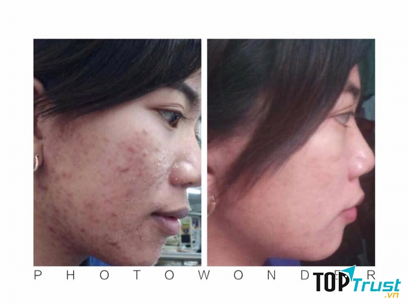 Ngô Thuỳ Spa Ngõ 16 Đường Mê Linh - Liên Bảo - Vĩnh Yên