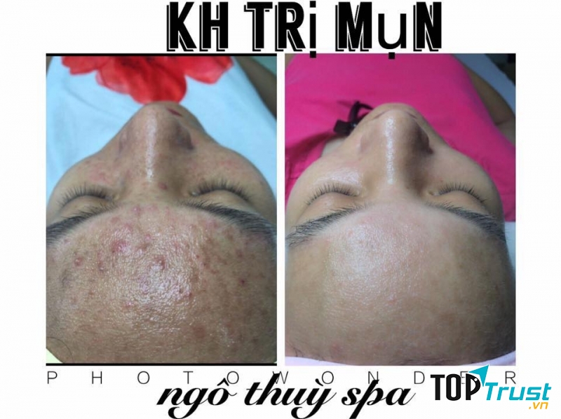 Ngô Thuỳ Spa Ngõ 16 Đường Mê Linh - Liên Bảo - Vĩnh Yên