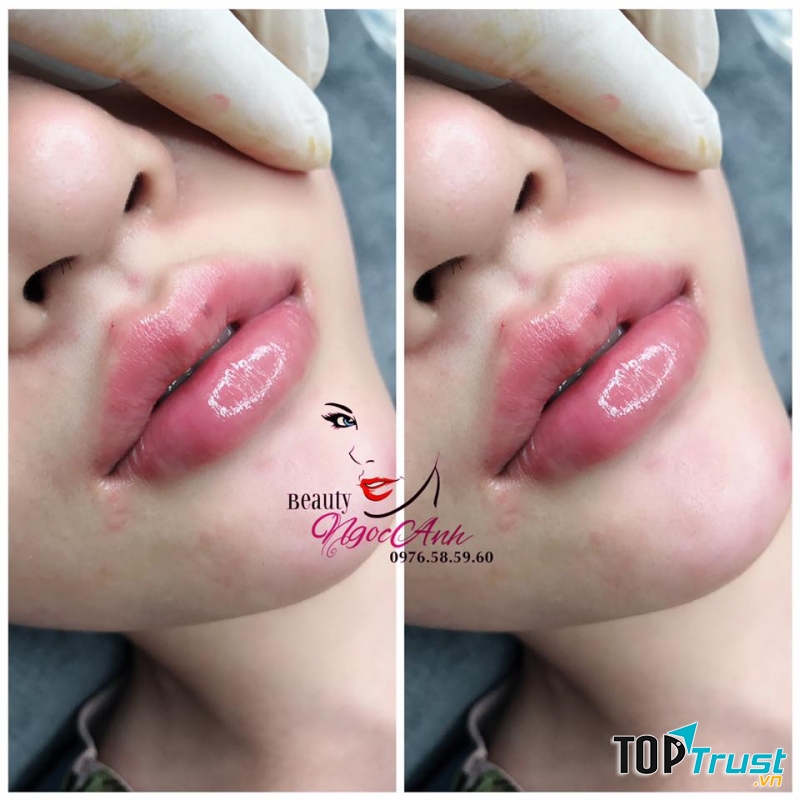 Ngọc Anh Beauty